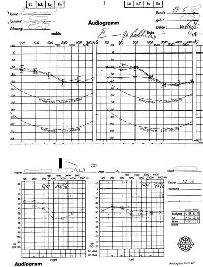 Audiogram