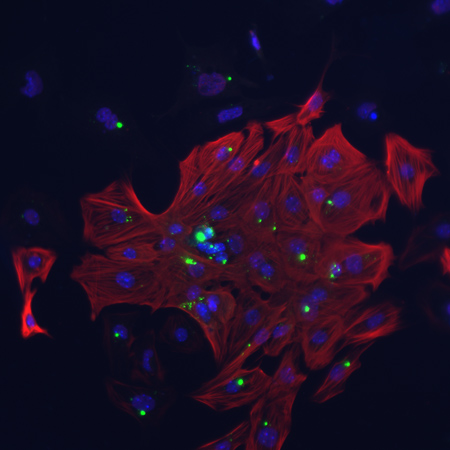 Fabry disease mouse cardiomyocytes stained for troponinI, Gb3Cer, DAPI 