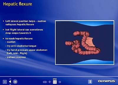 ScreenColonoscopy