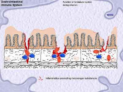 ScreenIBD1